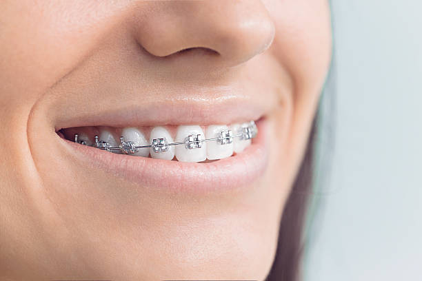 Best General Dentistry  in Albany, TX